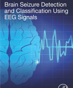 Brain Seizure Detection And Classification Using EEG Signals (EPUB)