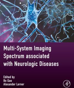 Multi-System Imaging Spectrum Associated With Neurologic Diseases (EPUB)