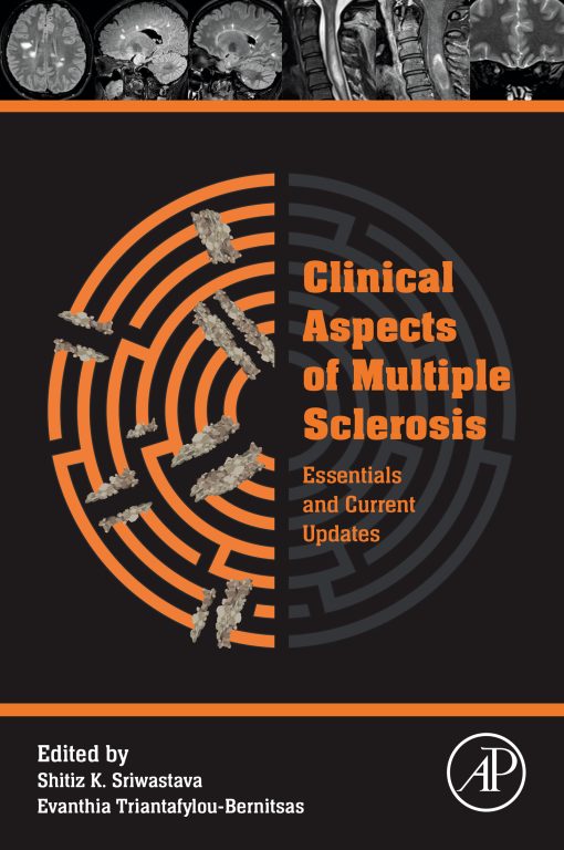 Clinical Aspects Of Multiple Sclerosis Essentials And Current Updates (PDF)