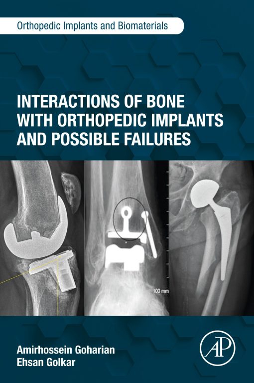 Interactions Of Bone With Orthopedic Implants And Possible Failures (PDF)