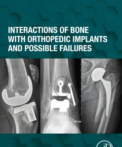 Interactions Of Bone With Orthopedic Implants And Possible Failures (EPUB)