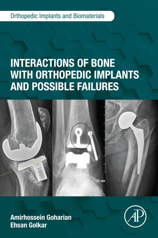 Interactions Of Bone With Orthopedic Implants And Possible Failures (EPUB)