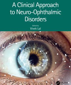 A Clinical Approach To Neuro-Ophthalmic Disorders (EPUB)