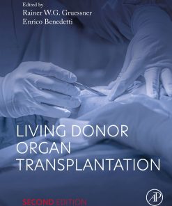 Living Donor Organ Transplantation, 2nd Edition (EPUB)