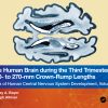 The Human Brain During The Third Trimester 310– To 350–Mm Crown-Rump Lengths: Atlas Of Central Nervous System Development, Volume 13 (EPUB)