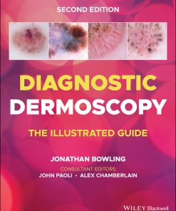 Diagnostic Dermoscopy: The Illustrated Guide, 2nd Edition (EPUB)