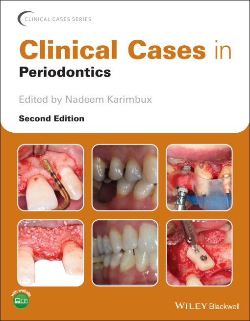 Clinical Cases In Periodontics, 2nd Edition (EPUB)