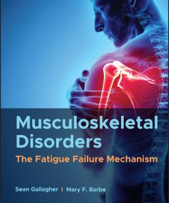 Musculoskeletal Disorders: The Fatigue Failure Mechanism (EPUB)