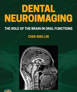 Dental Neuroimaging: The Role Of The Brain In Oral Functions (EPUB)