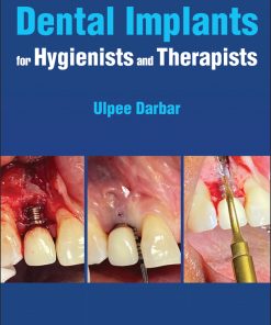 Dental Implants For Hygienists And Therapists (EPUB)