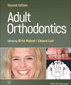 Adult Orthodontics, 2nd Edition (EPUB)