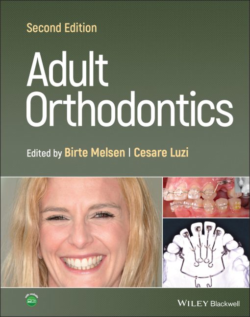 Adult Orthodontics, 2nd Edition (EPUB)