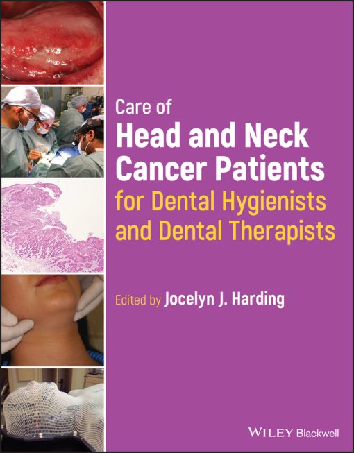 Care Of Head And Neck Cancer Patients For Dental Hygienists And Dental Therapists (EPUB)