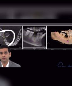 CBCT assisted dentistry