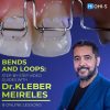 OHI-S Bends and Loops: Step-by-step Video Guides with Dr. Kleber Meireles