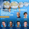 OHI-S- International Schools Working With Composite Restorations