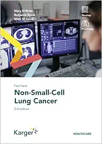 Fast Facts: Non-Small-Cell Lung Cancer, 2nd Edition (PDF)