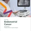 Fast Facts: Endometrial Cancer (PDF)