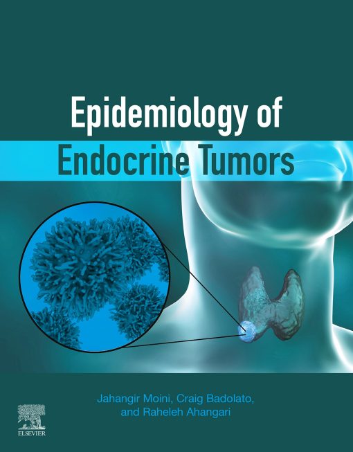 Epidemiology Of Endocrine Tumors (EPUB)