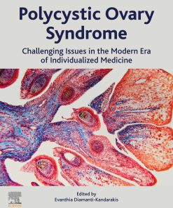 Polycystic Ovary Syndrome: Challenging Issues In The Modern Era Of Individualized Medicine (EPUB)