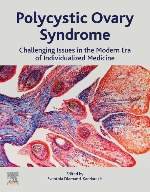 Polycystic Ovary Syndrome: Challenging Issues In The Modern Era Of Individualized Medicine (EPUB)