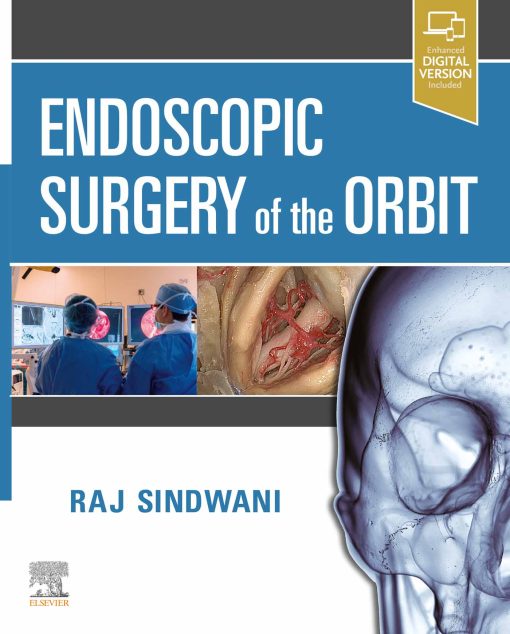 Endoscopic Surgery Of The Orbit (EPUB)