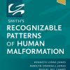 Smith’s Recognizable Patterns Of Human Malformation, 8th Edition (EPUB)