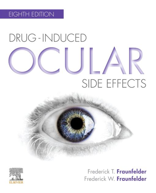 Drug-Induced Ocular Side Effects:Clinical Ocular Toxicology, 8th Edition (EPUB)