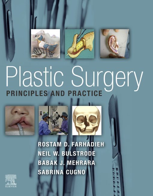 Plastic Surgery – Principles And Practice (EPUB)