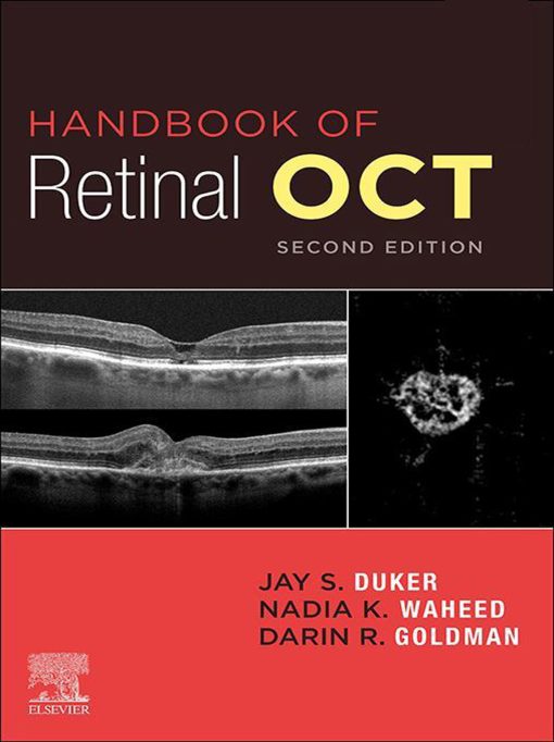 Handbook Of Retinal OCT: Optical Coherence Tomography, 2nd Edition (EPUB)