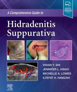 A Comprehensive Guide To Hidradenitis Suppurativa (EPUB)