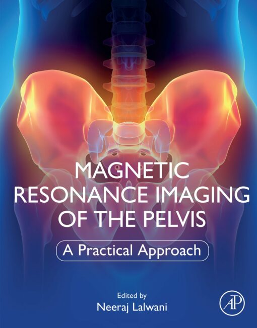 Magnetic Resonance Imaging Of The Pelvis: A Practical Approach (EPUB)