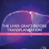 The Liver Graft Before Transplantation: Defining Outcome After Liver Transplantation (EPUB)