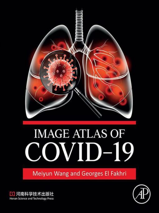 Image Atlas Of COVID-19 (EPUB)