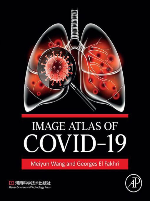 Image Atlas Of COVID-19 (PDF)