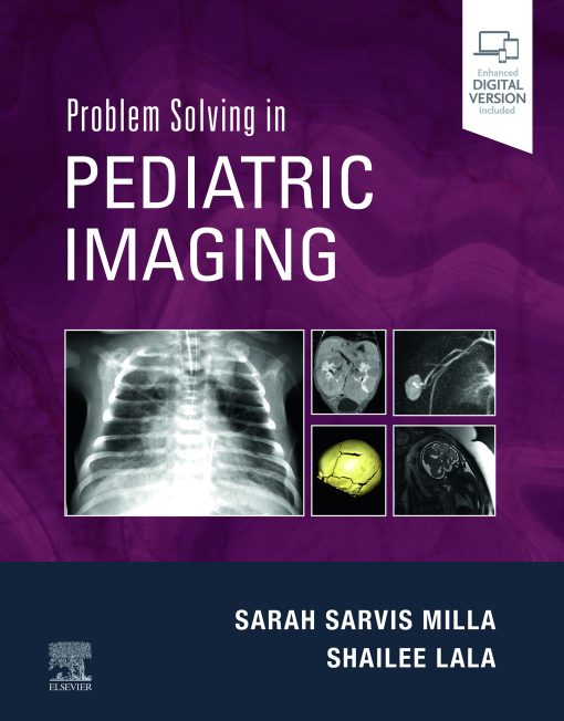 Problem Solving In Pediatric Imaging (EPUB)