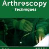 Arthroscopy Techniques PDF