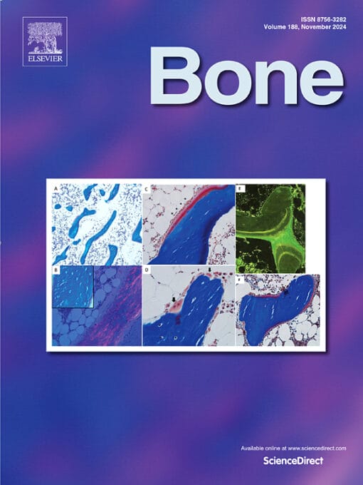 Bone PDF