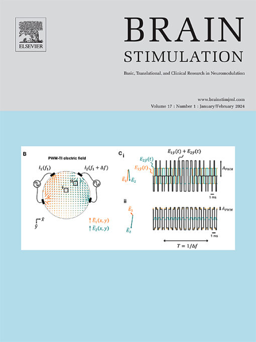 Brain Stimulation PDF