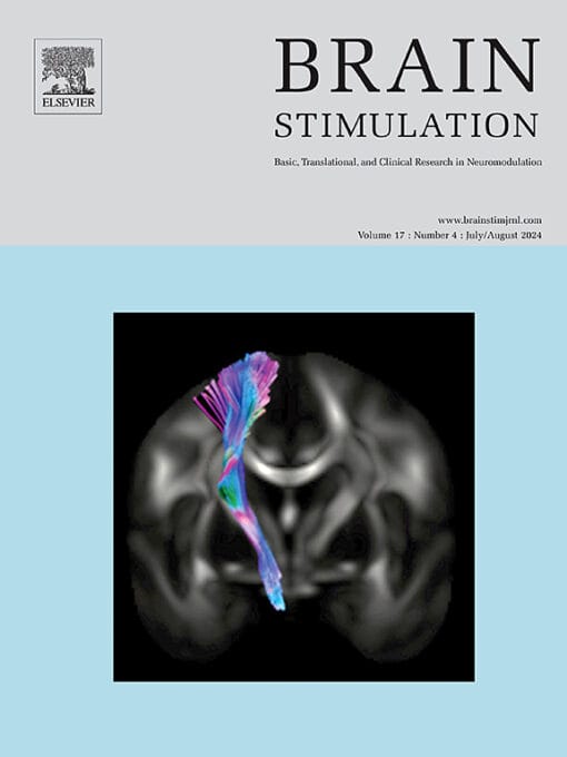 Brain Stimulation PDF