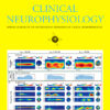 Clinical Neurophysiology Volume 159