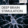 Deep Brain Stimulation PDF