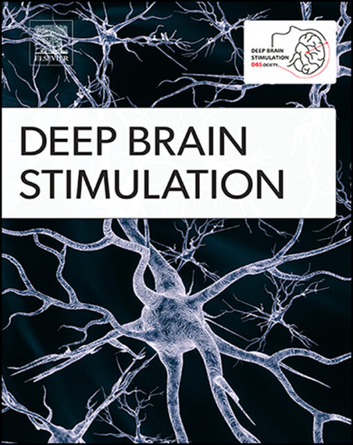 Deep Brain Stimulation PDF