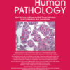 Human Pathology PDF