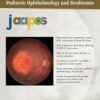 Journal of American Association for Pediatric Ophthalmology and Strabismus PDF