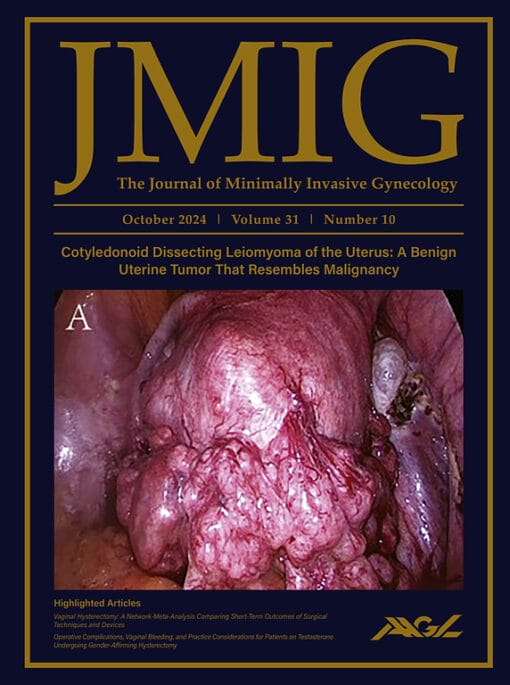 Journal of Minimally Invasive Gynecology PDF