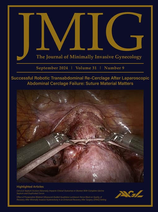 Journal of Minimally Invasive Gynecology PDF