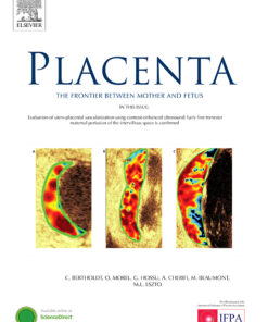 Placenta PDF