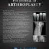 The Journal of Arthroplasty PDF