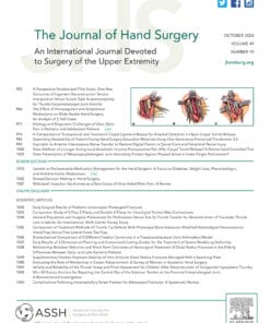 The Journal of Hand Surgery PDF